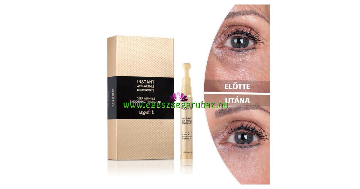 anti aging celluláris szem javító gél felülvizsgálata